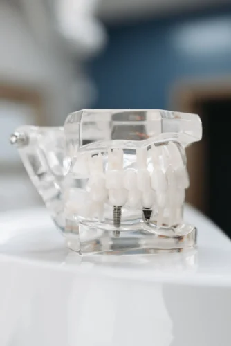Dental Implants Temple Tx - City Creek Dental
